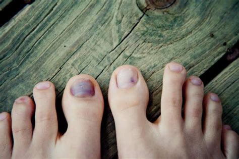 Por Que Tengo Las Uñas Moradas | Moda y Estilo