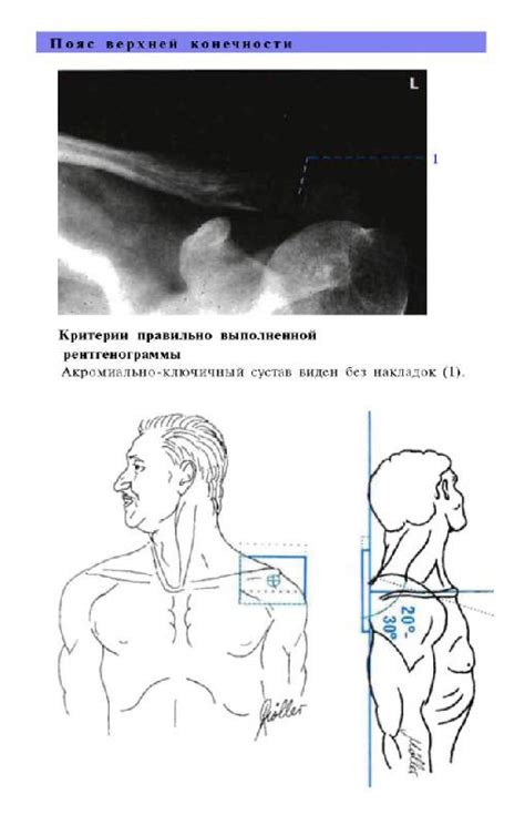 Книга: Атлас рентгенологических укладок - Меллер, Райф. Купить книгу ...