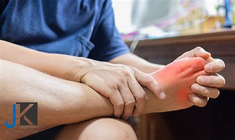Bệnh Gout là gì? Nguyên nhân, triệu chứng, cách chữa trị - Joker Việt Nam