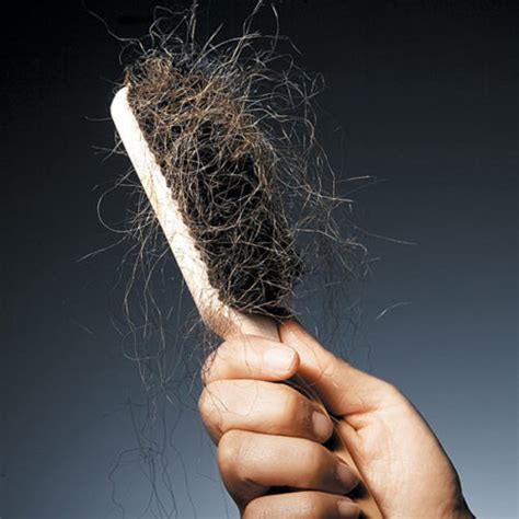 Does hair shedding play a role in hair loss? - Modena Hair Institute