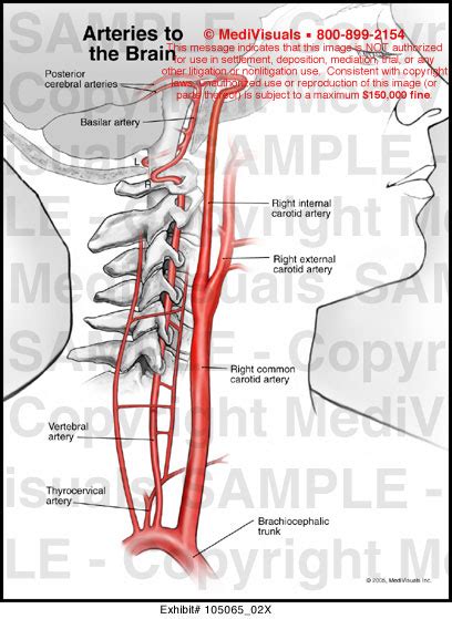 Arteries to the Brain Medical Illustration Medivisuals