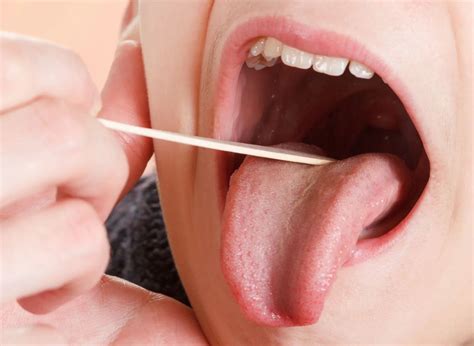Mandíbula Inchada De Um Lado - Amígdalas Inchadas: o que pode ser e como tratar