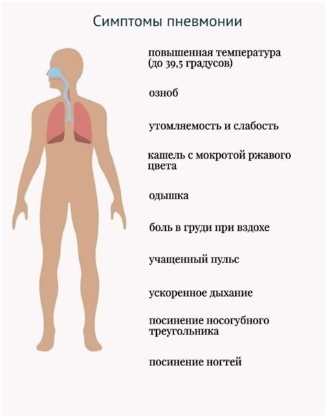 Пневмония - ГБУЗ СО «Новокуйбышевская центральная городская больница»