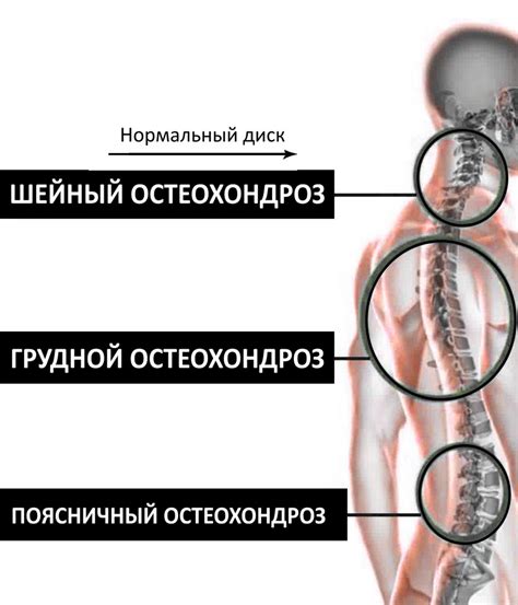 Ваш позвоночник нуждается в лечении, если...