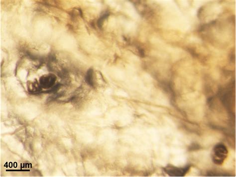 Digenean Trematodes In Hungarian Freshwater Aquacultures, 59% OFF