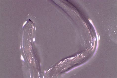 First Human Case of Eye Worm Thelazia Gulosa Found in Oregon Woman