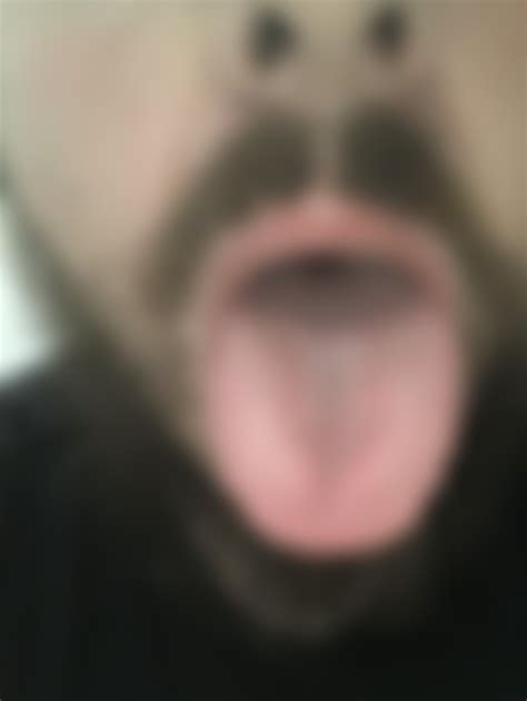 Is this tongue atrophy..:: I’m freaking out so bad : r/MuscleTwitch