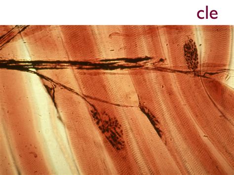 11.2 muscle contraction | PPT