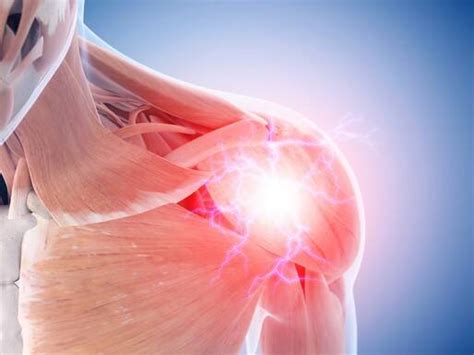 muscle pain  symptoms treatment symptom medicsparkcom