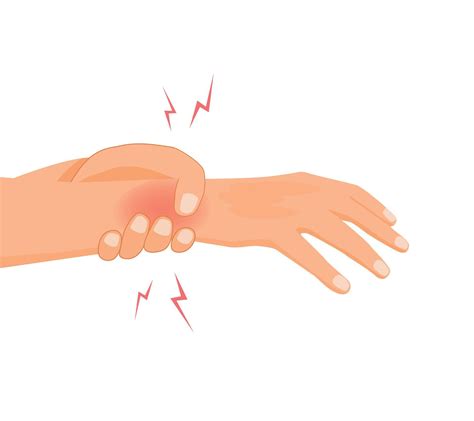 Wrist injury with carpal tunnel syndrome 52078309 Vector Art at Vecteezy