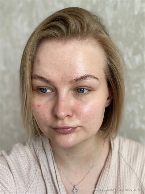 Говорю и показываю: Don’t touch my azacid, сыворотка с азелаиновой ...