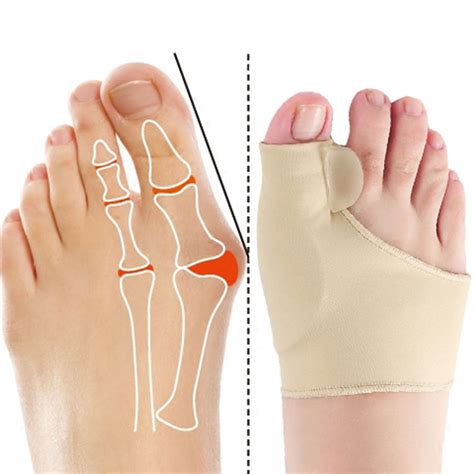 toe corrector kawaymigi