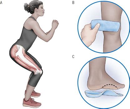 patellofemoral pain syndrome stretches pdf - Lorrine Randall