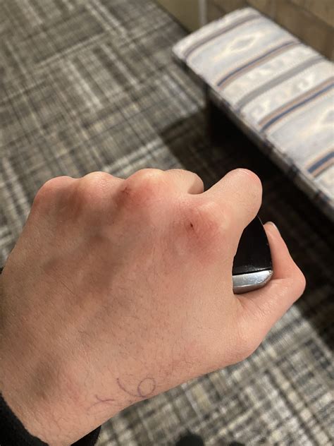 dry splitting knuckles  shift rbartenders