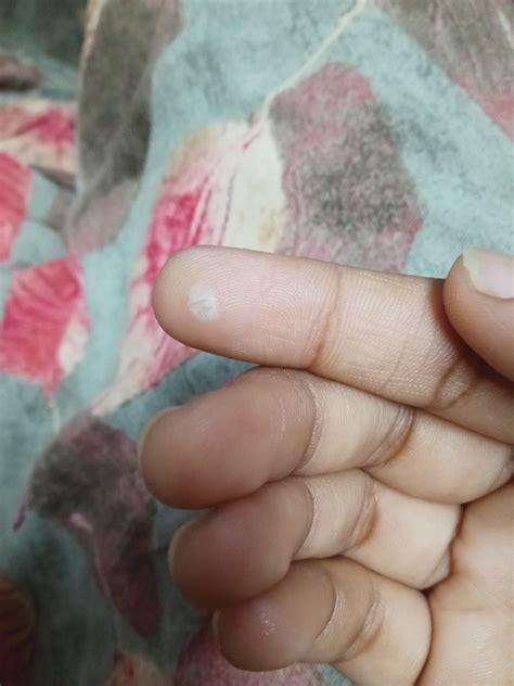 White discharge after period meaning if thick egg clear watery milky or