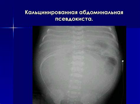 Рентгеносемиотика заболеваний ЖКТ - презентация онлайн