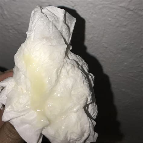 Can anyone tell me what this is? My vulva been really itchy, it burn to
