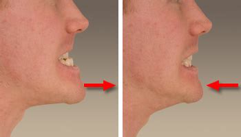 head  neck movements