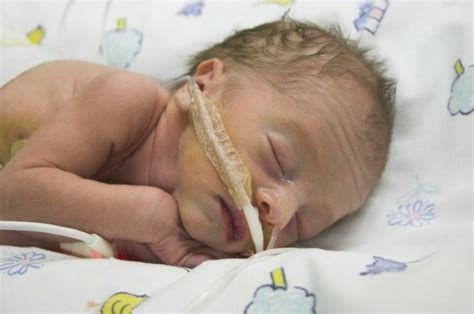 Premature Birth Complications: Everything You Should Know About It