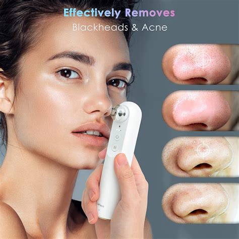 This Unbelievable Blackhead Removal 2024 Device Changed Everything For Me Image 5