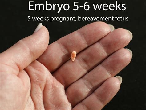 Embryo At A Week