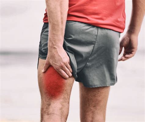 Hamstring Injuries: Causes, Symptoms, and Effective Treatments