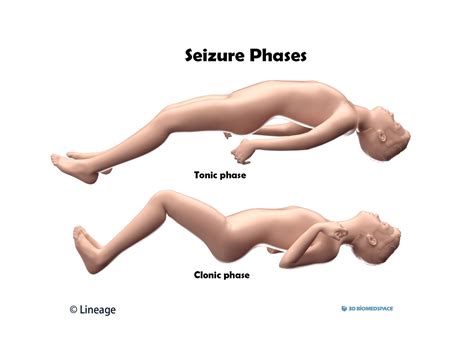 how to know if u had a seizure
