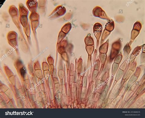 characteristics  fungi  microscope  amelie challis blog