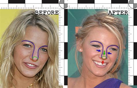 Blake Lively Nose Job