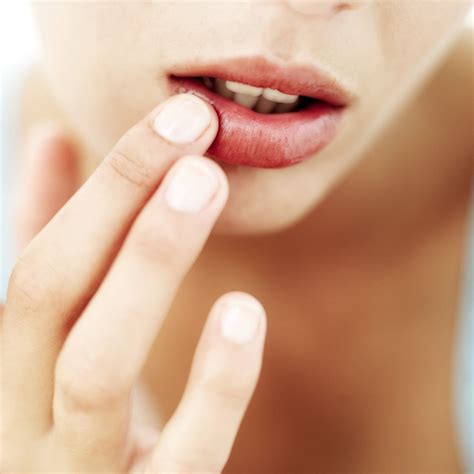 Why Lips Get Dry During Fever | Lipstutorial.org