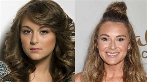 Alexa PenaVega's Plastic Surgery: Take a Look at the Before and After Pictures of The Spy Kids Star!