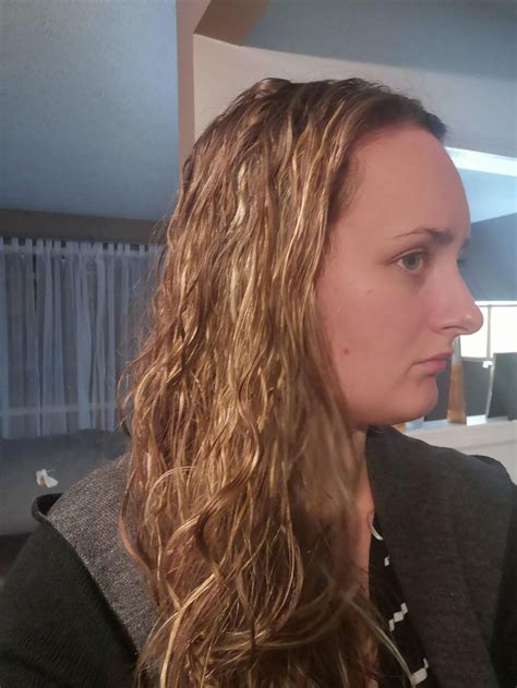 greasiest hair