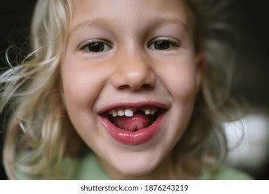 1,307 Close Kid Missing Teeth Images, Stock Photos & Vectors | Shutterstock