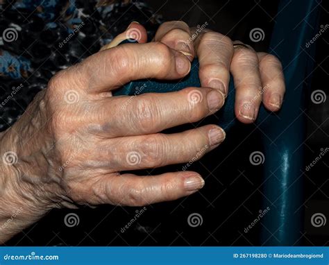 hands  caucasian elderly woman deformed  age stock photo image  care mature