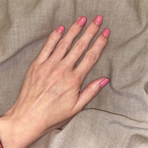 Why do my nails fold down like this?! Happens on these two fingers and