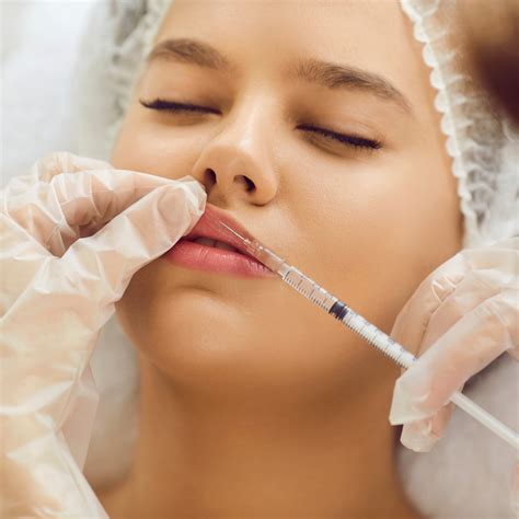 posibles efectos secundarios del acido hialuronico en labios ica