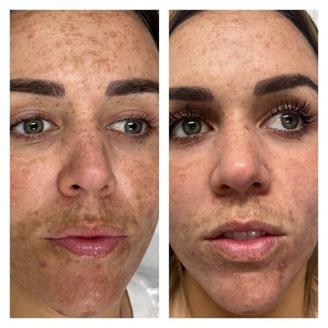 Brandybilly: Before And After Photos That Will Amaze You! Image 11