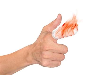 Bleeding Hand Stock Photos, Images and Backgrounds for Free Download