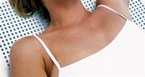 how to fix bad tan lines