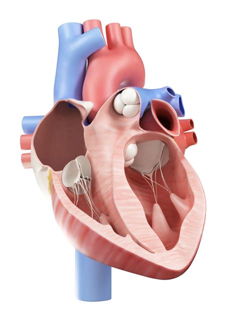 aortic valve replacement adelaide cardiothoracic