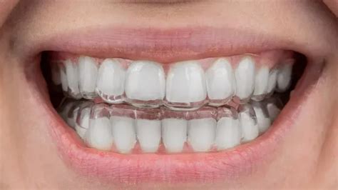 pretoria queenswood orthodontist