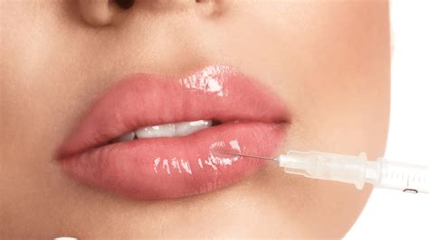 Belotero Filler Lips | Composition and Technique | Medical Spa Rx