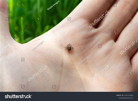 dust mite bites