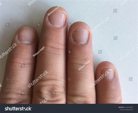 finger nails hand close bite biting stock photo  shutterstock