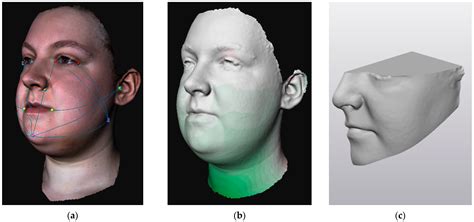 Reliability of 3D Stereophotogrammetry for Measuring Postoperative