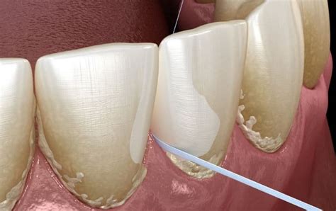 floss    brushing   order matters care
