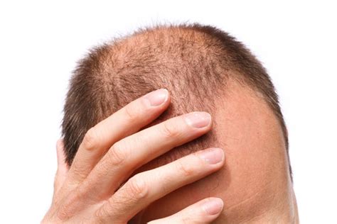 bald  adobe stock