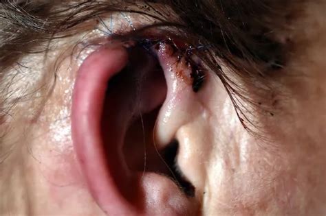 part  liverpool mums ear bitten   attackers