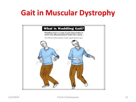 Muscular Dystrophy & Myasthenia Gravis ppt