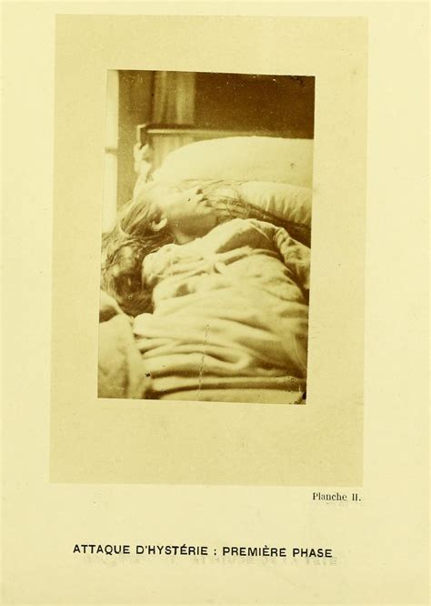 1877-80. Фотографии пациенток Больницы Сальпетрие́р в Париже: humus ...
